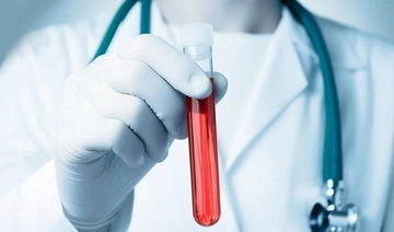 Crp Kantitatif Özellikleri ve Faydaları Nelerdir?